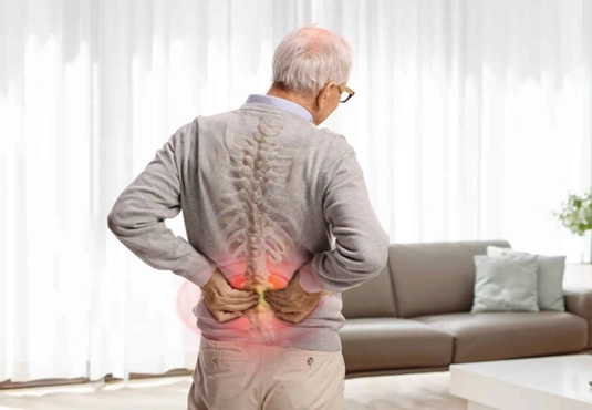 Bel Kayması (Spondilolistezis)